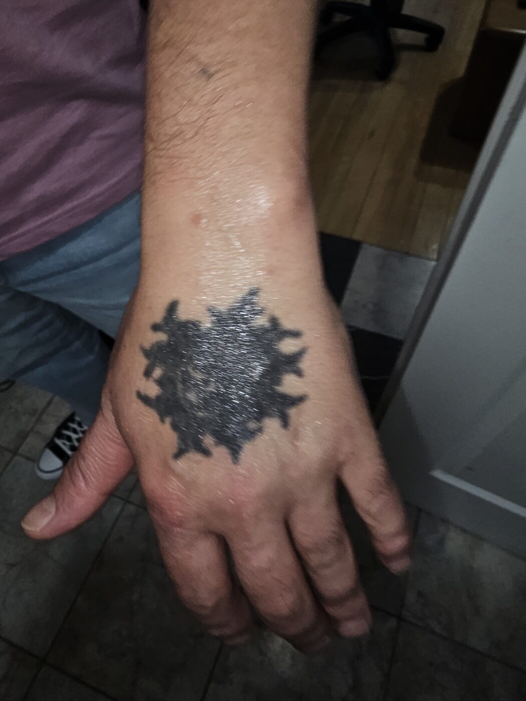 Old dark hand tattoo before Guy Abergel covered it